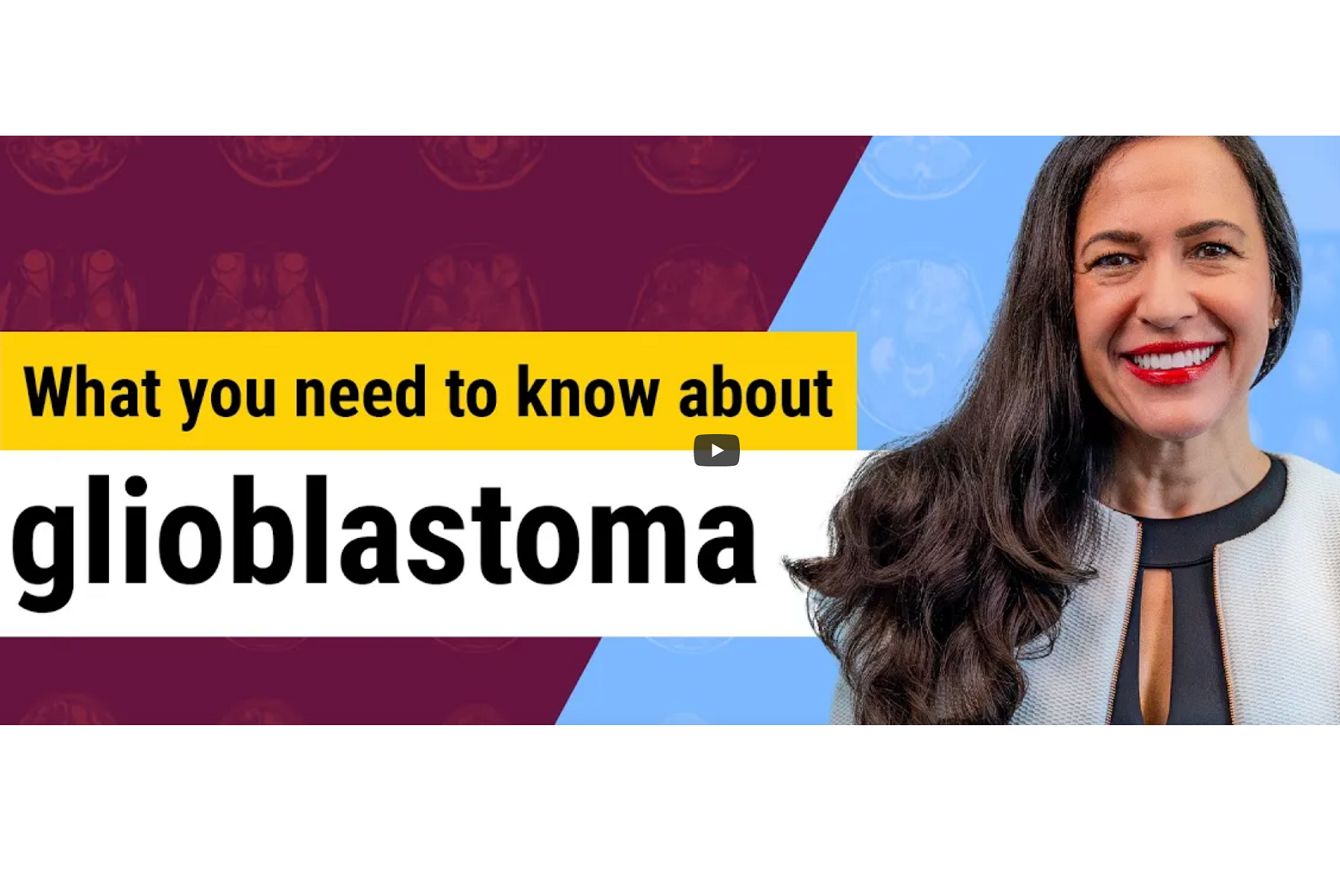 Glioblastoma-explainer